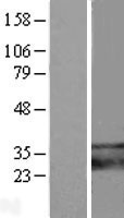 SARAF / TMEM66 Protein - Western validation with an anti-DDK antibody * L: Control HEK293 lysate R: Over-expression lysate