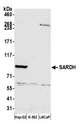 SARDH Antibody - Detection of human SARDH by western blot. Samples: Whole cell lysate (50 µg) from Hep-G2, K-562, and LNCaP cells prepared using NETN lysis buffer. Antibody: Affinity purified rabbit anti-SARDH antibody used for WB at 1:1000. Detection: Chemiluminescence with an exposure time of 75 seconds.