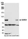 SARDH Antibody - Detection of human and mouse SARDH by western blot. Samples: Whole cell lysate (50 µg) from Hep-G2, K-562, LNCaP, and mouse TCMK-1 cells prepared using NETN lysis buffer. Antibody: Affinity purified rabbit anti-SARDH antibody used for WB at 1:1000. Detection: Chemiluminescence with an exposure time of 75 seconds.