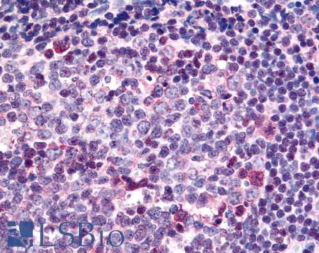 SARM1 / SARM Antibody - Anti-SARM1 / SARM antibody IHC of human tonsil. Immunohistochemistry of formalin-fixed, paraffin-embedded tissue after heat-induced antigen retrieval. Antibody concentration 2 ug/ml.
