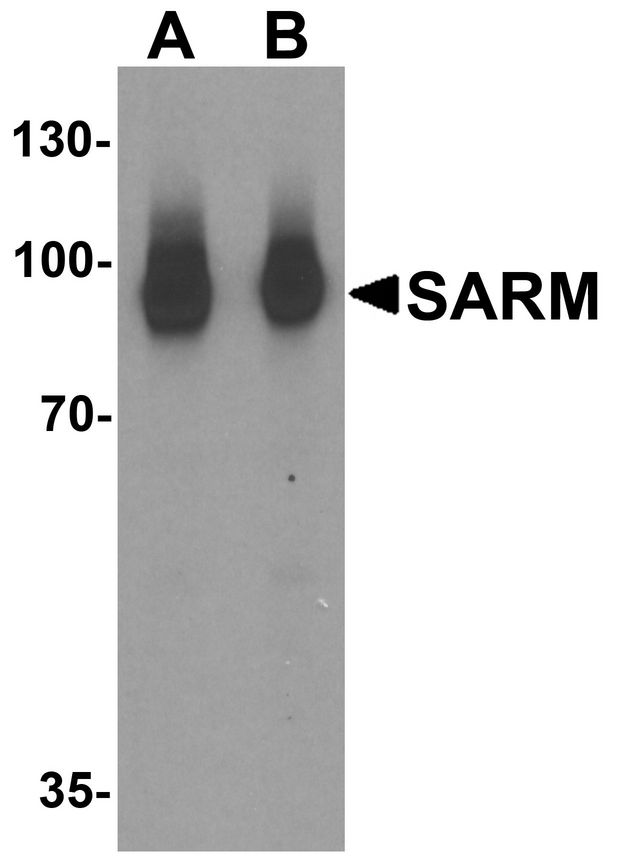 SARM1 / SARM Antibody - Western blot analysis of SARM in Daudi cell lysate with SARM antibody at (A) 1 and (B) 2 ug/ml.