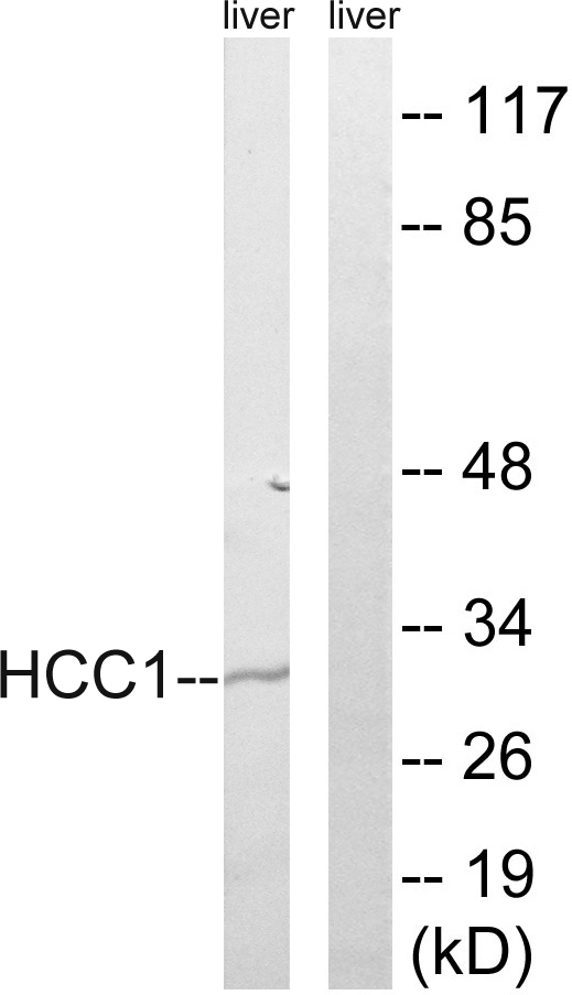 SARNP / Hcc-1 / CIP29 Antibody - Western blot analysis of lysates from mouse liver, using HCC1 Antibody. The lane on the right is blocked with the synthesized peptide.