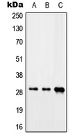 SARNP / Hcc-1 / CIP29 Antibody - Western blot analysis of CIP29 expression in Jurkat (A); mouse heart (B); rat liver (C) whole cell lysates.