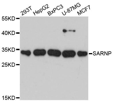 SARNP / Hcc-1 / CIP29 Antibody - Western blot analysis of extracts of various cell lines, using SARNP antibody at 1:3000 dilution. The secondary antibody used was an HRP Goat Anti-Rabbit IgG (H+L) at 1:10000 dilution. Lysates were loaded 25ug per lane and 3% nonfat dry milk in TBST was used for blocking. An ECL Kit was used for detection and the exposure time was 90s.