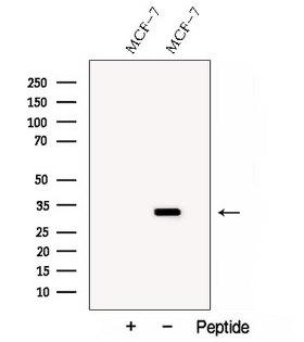SARNP / Hcc-1 / CIP29 Antibody