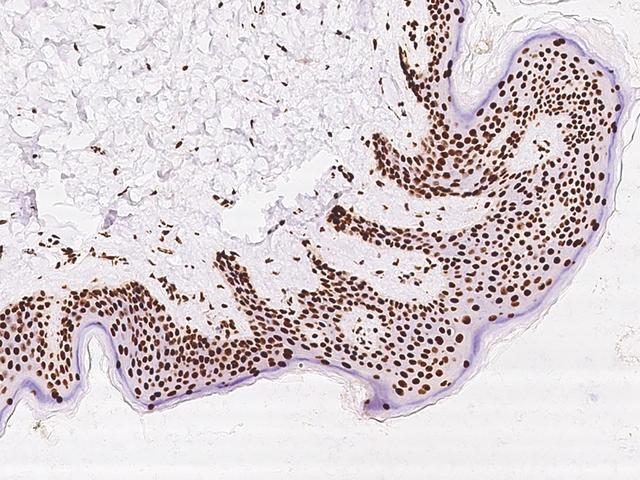 SARNP / Hcc-1 / CIP29 Antibody - Immunochemical staining of human SARNP in human skin with rabbit polyclonal antibody at 1:100 dilution, formalin-fixed paraffin embedded sections.