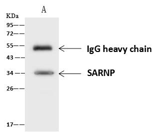 SARNP / Hcc-1 / CIP29 Antibody - SARNP was immunoprecipitated using: Lane A: 0.5 mg Jurkat Whole Cell Lysate. 4 uL anti-SARNP rabbit polyclonal antibody and 60 ug of Immunomagnetic beads Protein A/G. Primary antibody: Anti-SARNP rabbit polyclonal antibody, at 1:100 dilution. Secondary antibody: Goat Anti-Rabbit IgG (H+L)/HRP at 1/10000 dilution. Developed using the ECL technique. Performed under reducing conditions. Predicted band size: 24 kDa. Observed band size: 34 kDa.