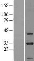 SARNP / Hcc-1 / CIP29 Protein - Western validation with an anti-DDK antibody * L: Control HEK293 lysate R: Over-expression lysate