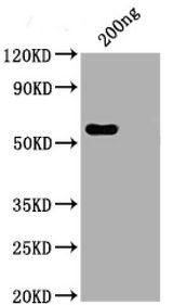 SARS-CoV-2 Nucleoprotein Antibody - Positive WB detected in: His tag-tagged SARS-CoV-2 nucleocapsid recombinant protein from E. Coli SARS-CoV-2 nucleocapsid antibody at 1:1000 Secondary Peroxidase-Affinipure Goat Anti-Human IgG, Fc? Fragment Specific at 1/20000 dilution Predicted band size: 48 kDa Observed band size: 55 kDa