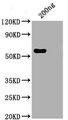 SARS-CoV-2 Nucleoprotein Antibody - Positive WB detected in: His tag-tagged SARS-CoV-2 nucleocapsid recombinant protein from E. Coli SARS-CoV-2 nucleocapsid antibody at 1:1000 Secondary Peroxidase-Affinipure Goat Anti-Human IgG, Fc? Fragment Specific at 1/20000 dilution Predicted band size: 48 kDa Observed band size: 55 kDa