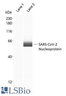 SARS-CoV-2 Nucleoprotein Antibody - Capillary Western Analysis of anti-SARS-CoV-2 Nucleoprotein antibody (LS-A13452, 1 mg/ml) using 12-230 kDa separation module. Lane 1: Negative Control, buffer only; Lane 2: SARS-CoV-2 Nucleocapsid Protein (10 ng/µl). (Protein Simple Virtual Blot)