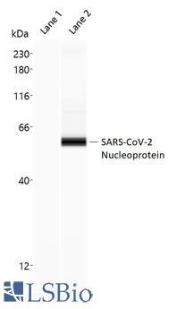 SARS-CoV-2 Nucleoprotein Antibody - Capillary Western Analysis of anti-SARS-CoV-2 Nucleoprotein antibody (LS-A13473, 1 mg/ml) using 12-230 kDa separation module. Lane 1: Negative Control, buffer only; Lane 2: SARS-CoV-2 Nucleocapsid Protein (10 ng/µl). (Protein Simple Virtual Blot)
