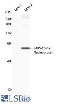 SARS-CoV-2 Nucleoprotein Antibody - Capillary Western Analysis of anti-SARS-CoV-2 Nucleoprotein antibody (LS-A13474, 1 mg/ml) using 12-230 kDa separation module. Lane 1: Negative Control, buffer only; Lane 2: SARS-CoV-2 Nucleocapsid Protein (10 ng/µl). (Protein Simple Virtual Blot)