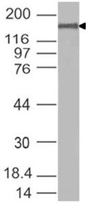 SARS-CoV-2 Spike Glycoprotein Antibody - Western Blot analysis of SARS-CoV-2 Spike Glycoprotein Antibody used at 2 µg/ml on full-length SARS-CoV-2 Spike Glycoprotein (150 ng/lane).