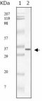 SARS-CoV M Protein Antibody - Western blot of SARS- mpm mouse mAb against SARS-mpm recombinant protein.