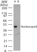 SARS-CoV Nucleoprotein Antibody - Western blot of SARS Nucleocapsid in (A) transfected mouse melanoma cell lysate and (B) untransfected cell lysate using antibody at a 1:2000 dilution.