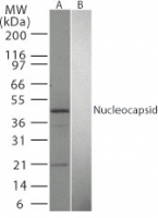 SARS-CoV Nucleoprotein Antibody - Western blot of SARS Nucleocapsid in (A) transfected mouse melanoma cell lysate and (B) untransfected cell lysate using antibody at 1:1000.