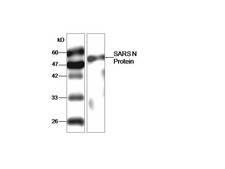 SARS-CoV Nucleoprotein Antibody