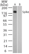 SARS-CoV Spike Glycoprotein Antibody - Western blot of Spike in (A) transfected and (B) untransfected mouse melanoma cell lysate using antibody at 0.05 ug/ml.
