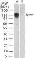 SARS-CoV Spike Glycoprotein Antibody - Western blot of SARS Spike in (A) transfected mouse melanoma cell lysate and (B) untransfected cell lysate using antibody.
