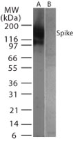 SARS-CoV Spike Glycoprotein Antibody - Western blot of SARS-Spike protein in full-length (A) transfected and (B) untransfected mouse melanoma cell lysate using antibody at 1:1000 dilution.