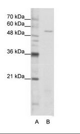 SARS / Serine-tRNA Ligase Antibody - A: Marker, B: Jurkat Cell Lysate.  This image was taken for the unconjugated form of this product. Other forms have not been tested.
