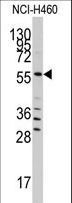 SARS / Serine-tRNA Ligase Antibody - Western blot of anti-SARS Antibody in NCI-H460 cell line lysates (35 ug/lane). SARS(arrow) was detected using the purified antibody.