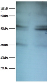 SARS / Serine-tRNA Ligase Antibody - Western blot of SARS protein antibody at 2 ug/ml. Lane 1: EC109 whole cell lysate. Lane 2: 293T whole cell lysate. Secondary: Goat polyclonal to Rabbit IgG at 1:15000 dilution. Predicted band size: 56 kDa. Observed band size: 56 kDa Additional bands at: 36 kDa. We are unsure as to the identity of this extra band.  This image was taken for the unconjugated form of this product. Other forms have not been tested.