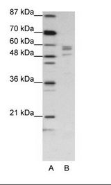 SARS / Serine-tRNA Ligase Antibody - A: Marker, B: Jurkat Cell Lysate.  This image was taken for the unconjugated form of this product. Other forms have not been tested.