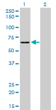 SARS / Serine-tRNA Ligase Antibody - Western blot of SARS expression in transfected 293T cell line by SARS monoclonal antibody (M01), clone 1H4.