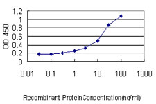 SARS / Serine-tRNA Ligase Antibody - Detection limit for recombinant GST tagged SARS is approximately 0.03 ng/ml as a capture antibody.