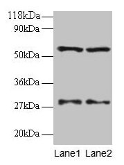 SARS / Serine-tRNA Ligase Antibody - Western blot All lanes: SARS protein antibody at 2µg/ml Lane 1: EC109 whole cell lysate Lane 2: 293T whole cell lysate Secondary Goat polyclonal to rabbit IgG at 1/15000 dilution Predicted band size: 56 kDa Observed band size: 56 kDa
