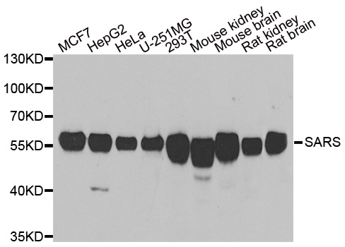 SARS / Serine-tRNA Ligase Antibody - Western blot analysis of extracts of various cell lines.