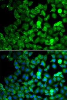 SARS / Serine-tRNA Ligase Antibody - Immunofluorescence analysis of MCF7 cells.