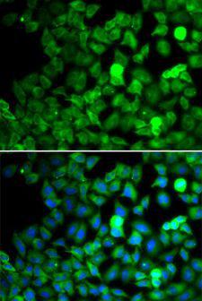 SARS / Serine-tRNA Ligase Antibody - Immunofluorescence analysis of MCF-7 cells using SARS antibody. Blue: DAPI for nuclear staining.