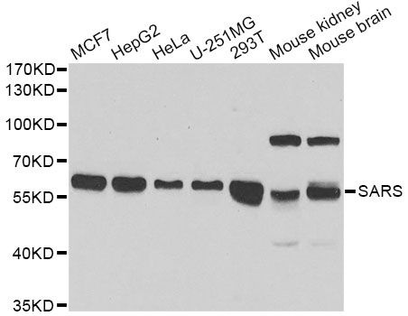 SARS / Serine-tRNA Ligase Antibody - Western blot analysis of extracts of various cell lines, using SARS antibody at 1:1000 dilution. The secondary antibody used was an HRP Goat Anti-Rabbit IgG (H+L) at 1:10000 dilution. Lysates were loaded 25ug per lane and 3% nonfat dry milk in TBST was used for blocking. An ECL Kit was used for detection and the exposure time was 90s.
