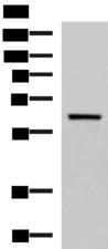 SARS / Serine-tRNA Ligase Antibody - Western blot analysis of Human fetal brain tissue lysate  using SARS Polyclonal Antibody at dilution of 1:850