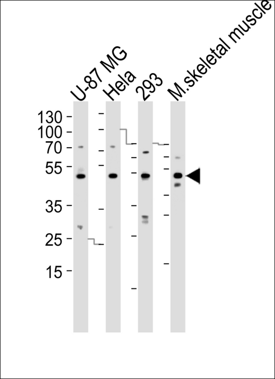 SARS2 / SYS Antibody - Western blot of lysates from U-87 MG, HeLa, 293 cell line and mouse skeletal muscle tissue lysate(from left to right), using SARS2 Antibody. Antibody was diluted at 1:1000 at each lane. A goat anti-rabbit IgG H&L (HRP) at 1:5000 dilution was used as the secondary antibody. Lysates at 35ug per lane.
