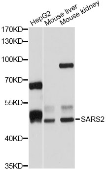 SARS2 / SYS Antibody - Western blot analysis of extracts of various cell lines, using SARS2 antibody at 1:1000 dilution. The secondary antibody used was an HRP Goat Anti-Rabbit IgG (H+L) at 1:10000 dilution. Lysates were loaded 25ug per lane and 3% nonfat dry milk in TBST was used for blocking. An ECL Kit was used for detection and the exposure time was 10s.