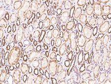 SARS2 / SYS Antibody - Immunochemical staining of human SARS2 in human kidney with rabbit polyclonal antibody at 1:100 dilution, formalin-fixed paraffin embedded sections.