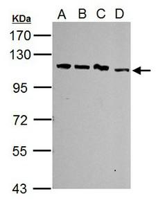 SART1 Antibody - Sample (30 ug of whole cell lysate). A: Jurkat, B: Raji, C: K562, D: NCI-H929. 7.5% SDS PAGE. SART1 antibody diluted at 1:5000.