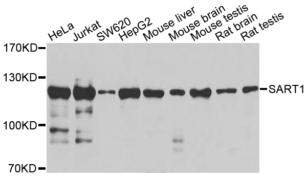 SART1 Antibody - Western blot analysis of extracts of various cell lines.