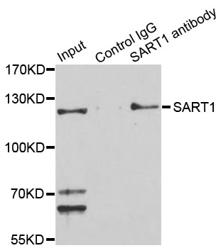 SART1 Antibody - Immunoprecipitation analysis of 150ug extracts of Jurkat cells.