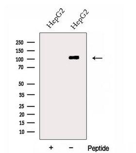 SART2 / DSE Antibody - Western blot analysis of extracts of HepG2 cells using DSE antibody. The lane on the left was treated with blocking peptide.