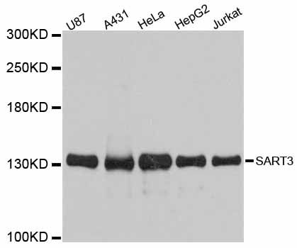 SART3 Antibody - Western blot analysis of extracts of various cell lines, using SART3 antibody at 1:3000 dilution. The secondary antibody used was an HRP Goat Anti-Rabbit IgG (H+L) at 1:10000 dilution. Lysates were loaded 25ug per lane and 3% nonfat dry milk in TBST was used for blocking. An ECL Kit was used for detection and the exposure time was 30s.