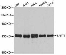 SART3 Antibody - Western blot analysis of extracts of various cell lines, using SART3 antibody at 1:3000 dilution. The secondary antibody used was an HRP Goat Anti-Rabbit IgG (H+L) at 1:10000 dilution. Lysates were loaded 25ug per lane and 3% nonfat dry milk in TBST was used for blocking. An ECL Kit was used for detection and the exposure time was 30s.