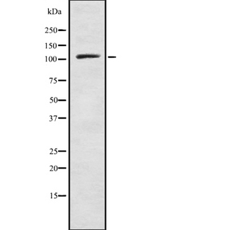 SART3 Antibody - Western blot analysis SART3 using HeLa whole cells lysates