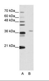 SART3 Antibody - A: Marker, B: Jurkat Cell Lysate.  This image was taken for the unconjugated form of this product. Other forms have not been tested.