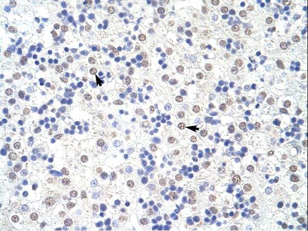 SART3 Antibody - SART3 antibody ARP39128_T100-AAK69347-SART3 (squamous cell carcinoma antigen recognized by T cells 3) Antibody was used in IHC to stain formalin-fixed, paraffin-embedded human liver.  This image was taken for the unconjugated form of this product. Other forms have not been tested.