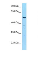 SAS6 / SASS6 Antibody - SASS6 antibody Western blot of MCF7 Cell lysate. Antibody concentration 1 ug/ml.  This image was taken for the unconjugated form of this product. Other forms have not been tested.
